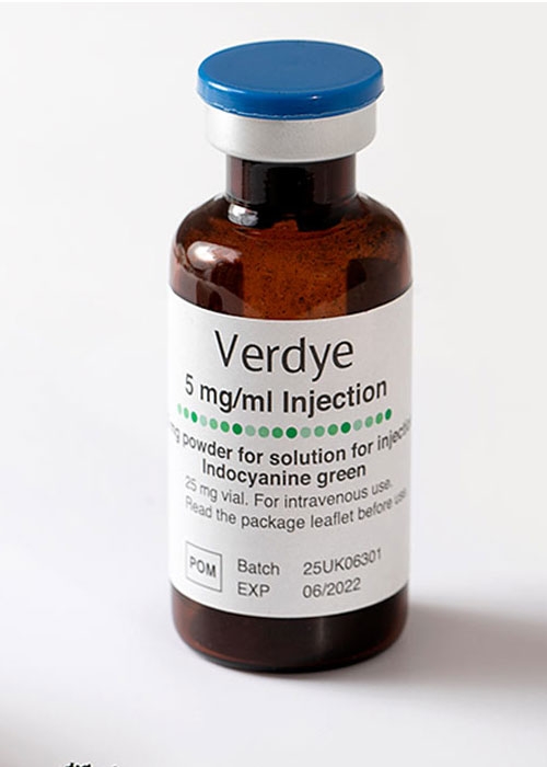 Verdye